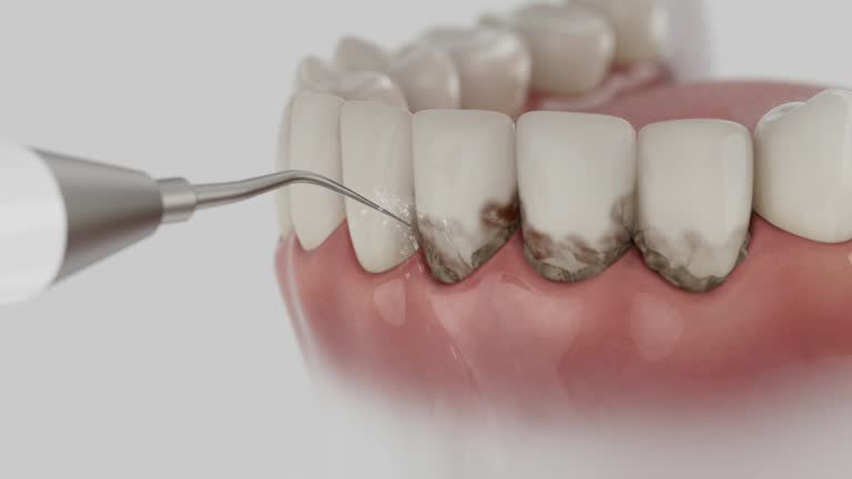 Trusted Teeth Whitening service in Tonkawa, OK - Dentist Open Now